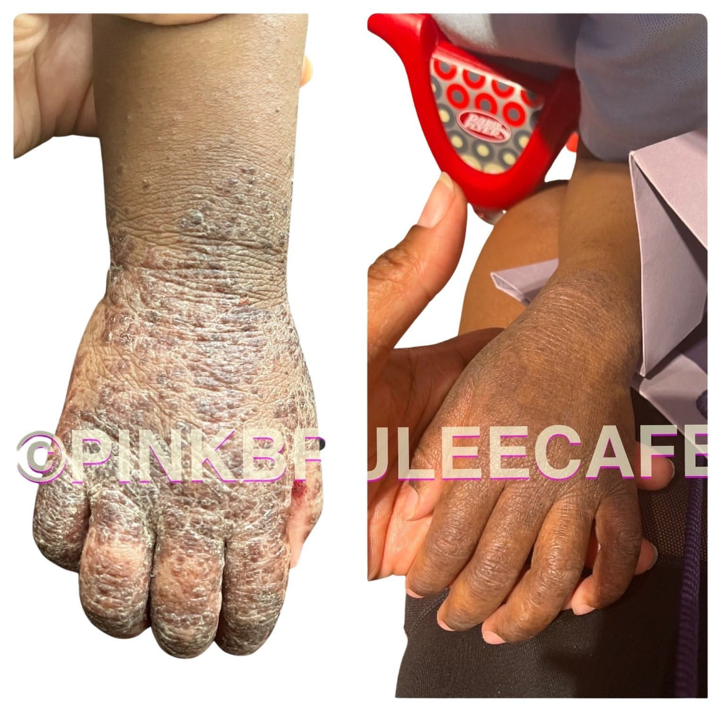 Whipped Triple Butter